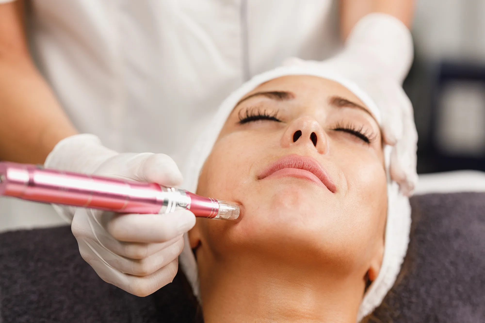 Microneedling, Facial, Eye Designer, Soin du Visage