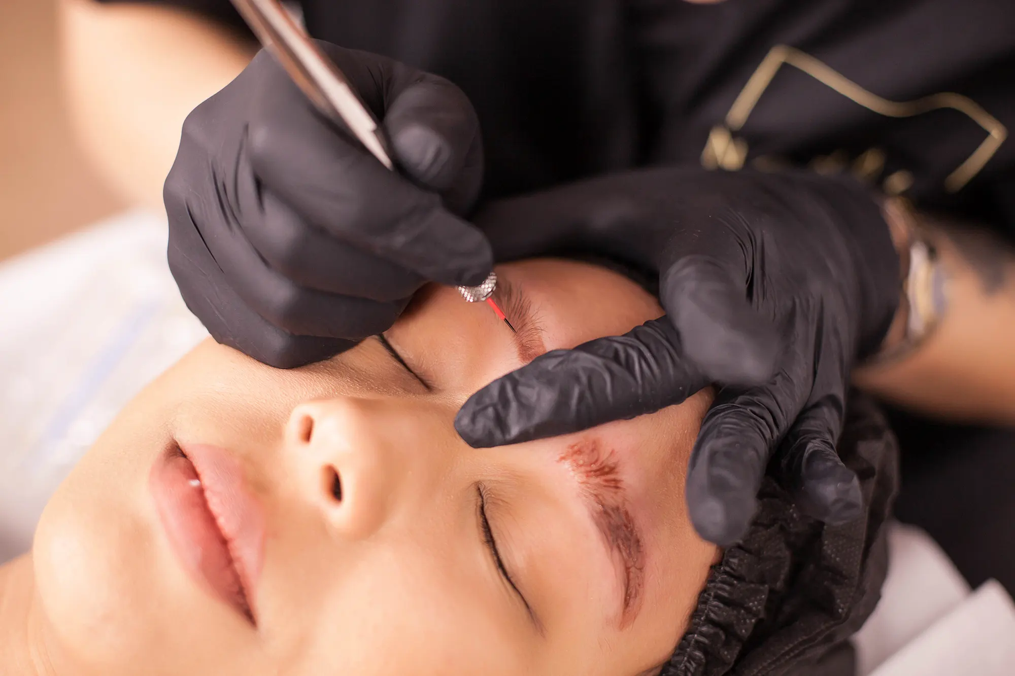 Non-Laser Tattoo Removal, Phiremoval, Tattoo Removal, Eye Designer