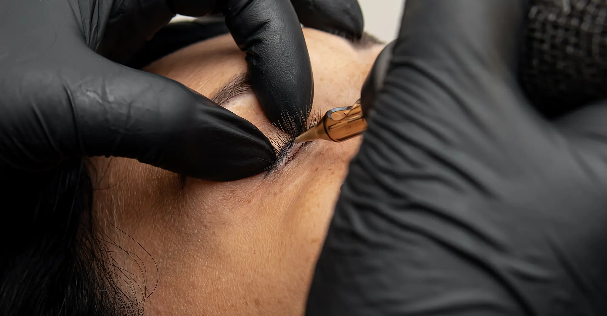 Non-Laser Tattoo Removal, Phiremoval, Tattoo Removal, Eye Designer